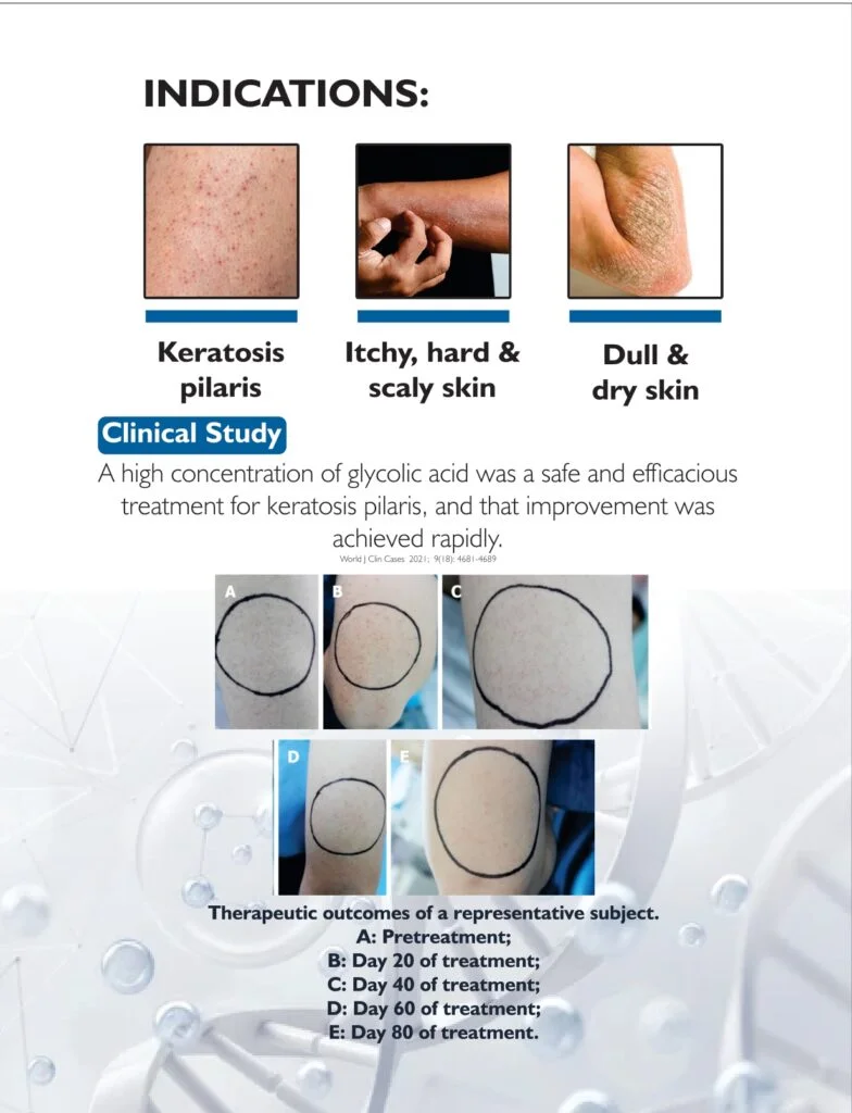 AHA Body Lotion 15 - Image 4